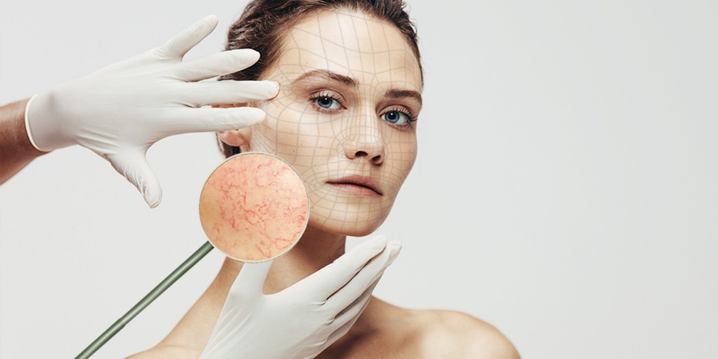 сосудистые звездочки на лице.jpg