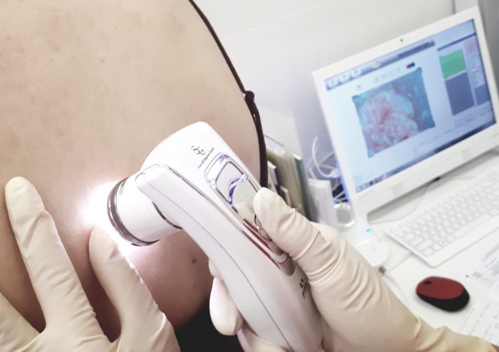 лечение на процедуре дерматоскопии