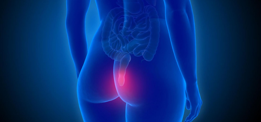 Появление тромбоза геморроидальных узлов