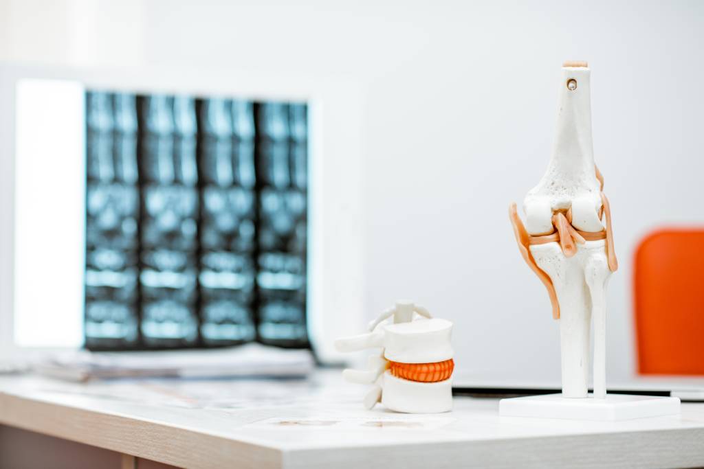 Протрузия дисков позвоночника на искусственных костях