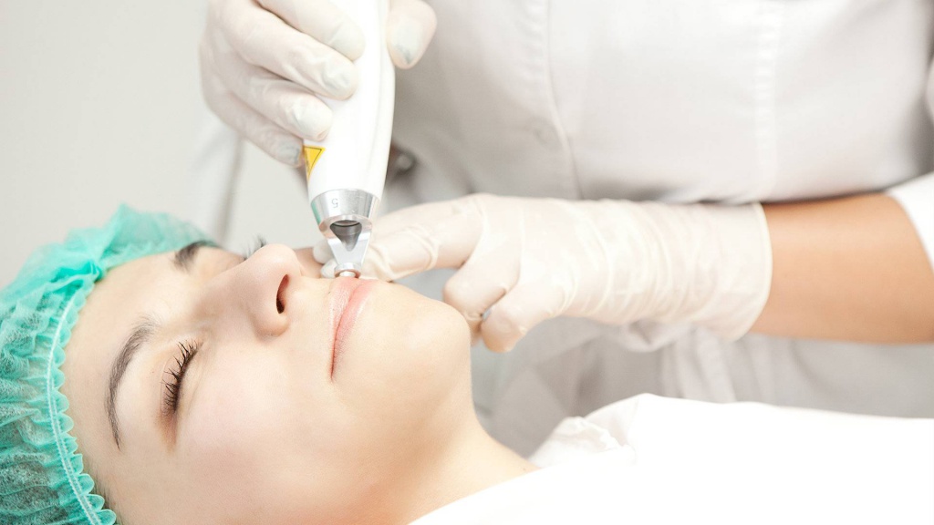 Лазерное удаление сосудистых звездочек на лице