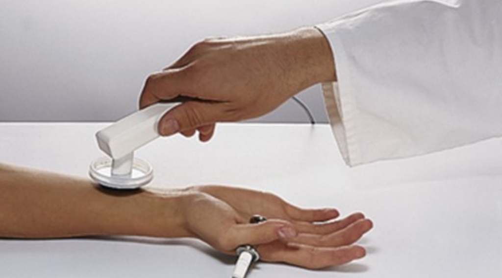 Врач проводит хивамат-терапию