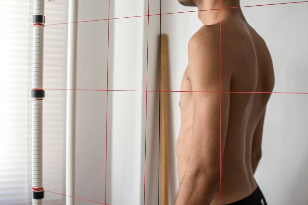 Молодой человек стоит на осмотре при подозрении на лордоз