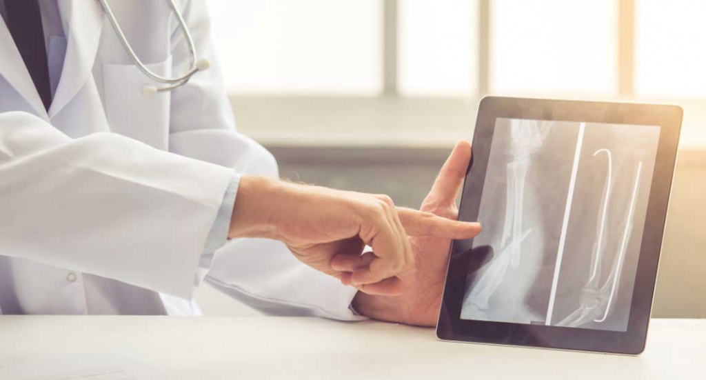 Травматолог на консультации после снимка показывает перелом кости