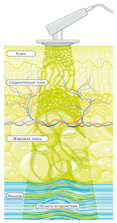 Воздействие электростатических импульсов